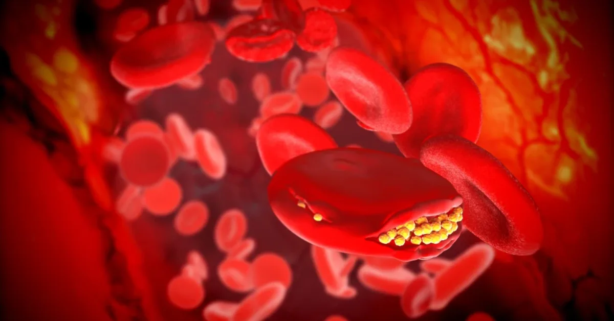 Leukemia
