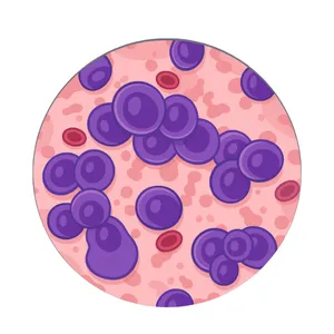 Acute Promyelocytic Leukemia