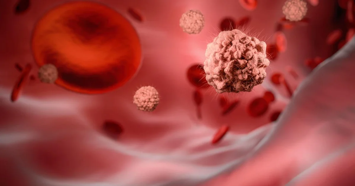 Blood Cancer