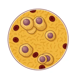 SMM