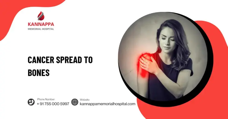 Cancer Spread to Bones
